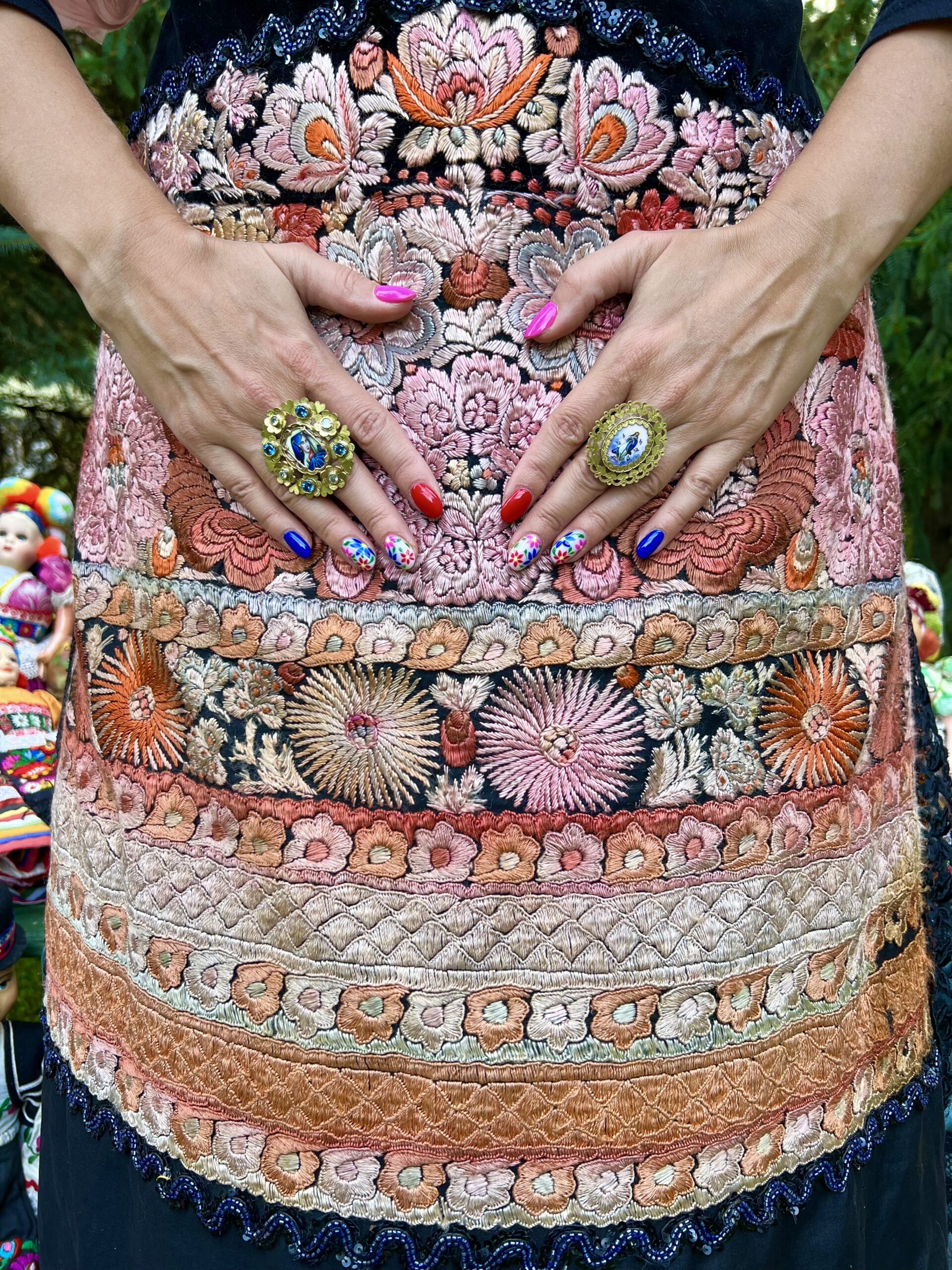 HALLOTTATOK A NAGY MATYÓ VISELET ÉGETÉSRŐL?